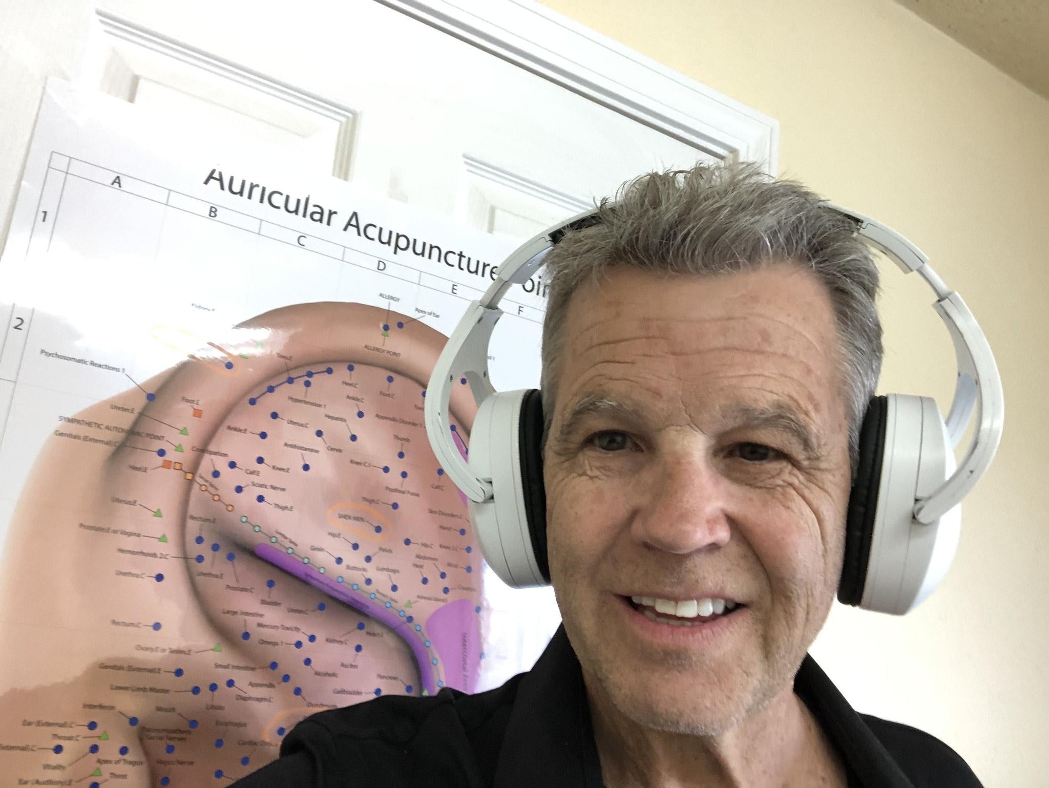 Jerry, wearing AcupressEar showcasing acupressure benefits